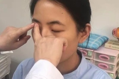 Nếu mắt có 5 dấu hiệu này nên đi khám ngay bởi đó có thể là cảnh báo của ung thư