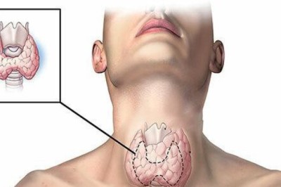 Dấu hiệu bất thường cảnh báo nguy cơ bị ung thư tuyến giáp, tuyệt đối không được bỏ qua