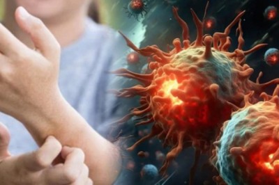 Người bệnh nhân ung thư tuyến tụy có chung '1 triệu chứng không ngờ tới'