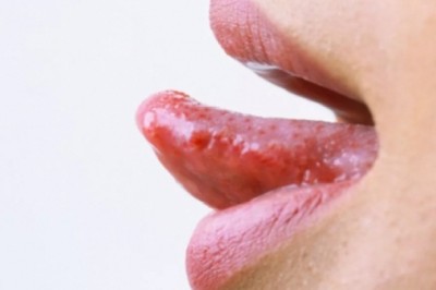 5 dấu hiệu ở lưỡi cảnh báo cả loạt bệnh nguy hiểm đang cận kề, từ bệnh gan, đột quỵ tới ung thư