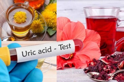 Người (Bệnh Gút) còn gọi nồng độ axit uric trong máu cao đây là 4 Loại Thảo Dược nên hàng hàng ngày