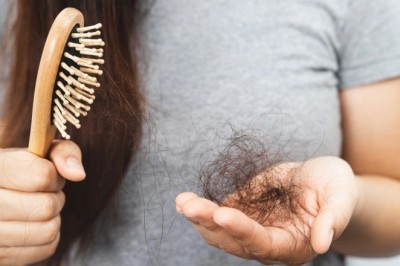 Bài thuốc đông y hỗ trợ trị BỆNH RỤNG TÓC