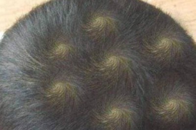 Trẻ có 2 xoáy tóc thông minh hơn? Nghiên cứu khoa học đưa ra đáp án thực sự