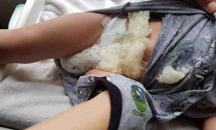 Các bậc cha mẹ đã phàn nàn về tã Huggies