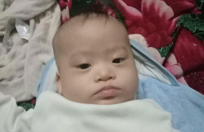 Trả lời bởi: BS. Hương Lan