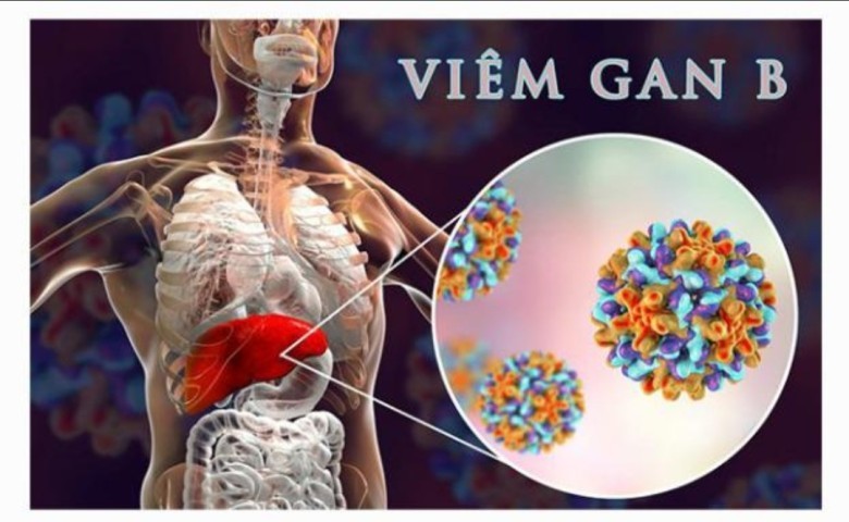 Viêm gan B nguy hiểm thế nào?
