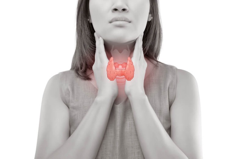 Triệu chứng của bệnh Basedow