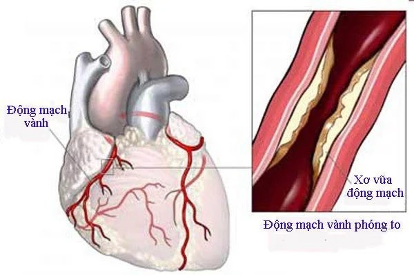 2. Một số biện pháp sử dụng củ nghệ để chữa bệnh