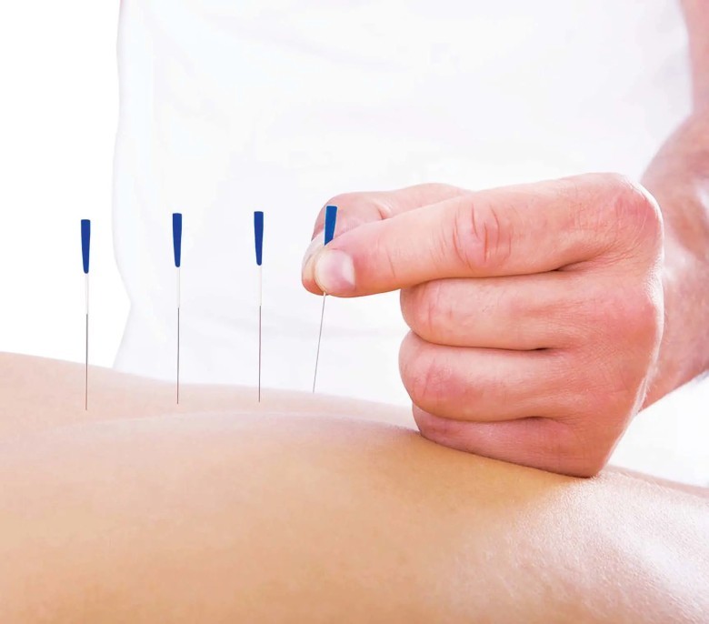 Châm cứu bấm huyệt đang dần khẳng định vị thế trong nước và quốc tế