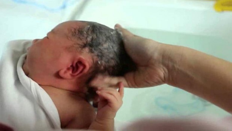 Cách tắm cho trẻ sơ sinh đúng cách