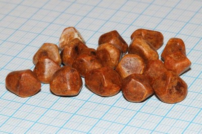 Bệnh Sỏi mật là gì, điều trị Sỏi mật thế nào hiệu quả