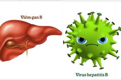 Bệnh viêm gan B là gì ? con đường lây nhiễm của bệnh Viêm Gan B
