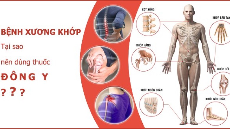 Cách chữa đau nhức xương khớp tại nhà đơn giản, hiệu quả từ cây thuốc, Bài thuốc quen thuộc