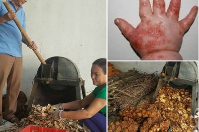 Lá tắm hỗ trợ chữa tay chân miệng chỉ 3 ngày là khỏi của y sĩ Nguyễn Văn Chắt ở Lạng Sơn