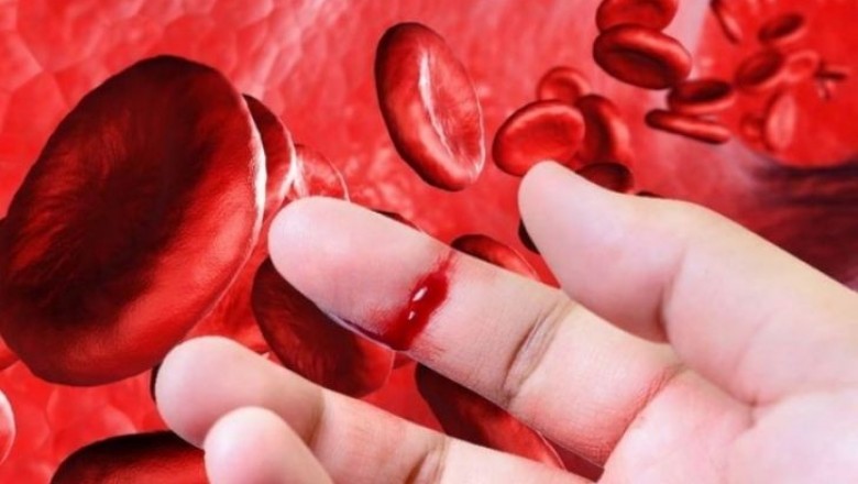 Hiểu về bệnh Hemophilia để tránh mang thêm những nỗi đau