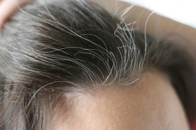 Bài thuốc dân gian cải thiện máu xấu, tóc bạc sớm hiệu quả ngay tại nhà dụng thảo dược Hà Thủ Ô