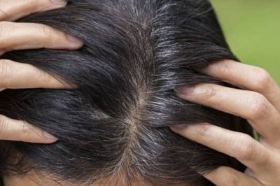 Bài thuốc đông y chữa tóc bạc sớm