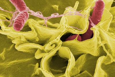 Thông tin về Salmonella (bệnh nhiễm khuẩn salmonella)