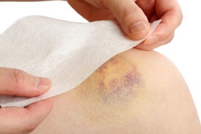 12 dấu hiệu thầm lặng của bệnh ung thư bạch cầu