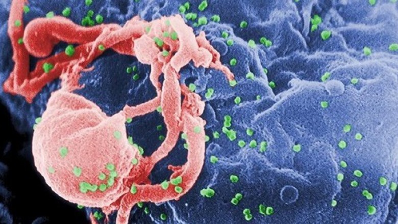 Thêm bệnh nhân thứ 3 chữa khỏi HIV