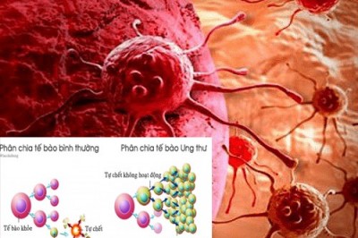 Những bí ẩn ít biết về Tế bào ung thư