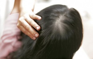 Tóc rụng nhiều phải làm sao để chấm dứt?