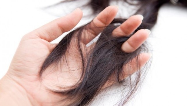 Những bài thuốc thiên nhiên ngăn tóc rụng