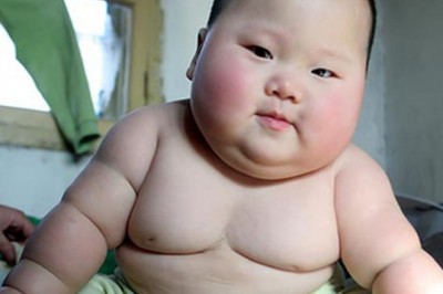 Quan niệm và điều trị béo phì theo y học cổ truyền