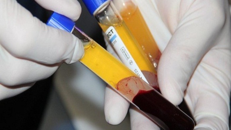 Huyết tương của người khỏi bệnh có thể diệt Virus Corona