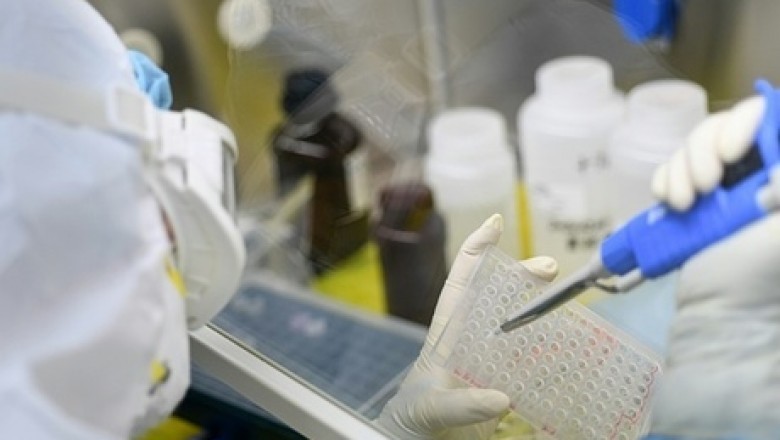Cơ chế gây chết người của virus corona