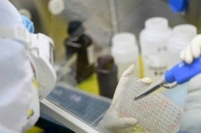 Cơ chế gây chết người của virus corona