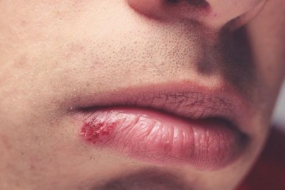 Bệnh thường gặp: Nhìn dấu hiệu trên mặt cảnh báo sức khỏe cần đi khám bác sĩ ngay