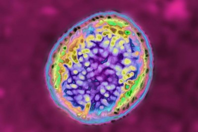 Hơn 6.600 người ở Trung Quốc mắc bệnh Brucellosis