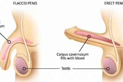 Hội chứng khiến cương dương nhiều giờ thuộc bệnh lý cấp cứu tối khẩn