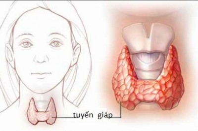 Suy tuyến giáp: Thủ phạm giấu mặt gây hiếm muộn