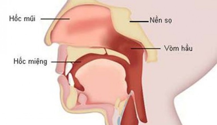 Phân biệt ung thư vòm họng với bệnh lý vùng mũi họng