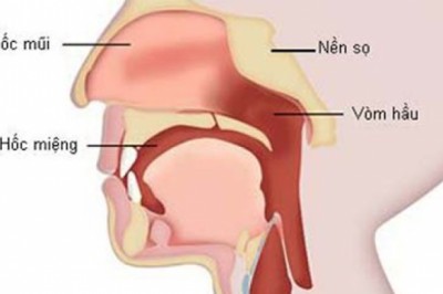 Phân biệt ung thư vòm họng với bệnh lý vùng mũi họng