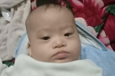 Hỏi đáp bệnh Down: Bé mắc hội chứng Down, có phòng được không?