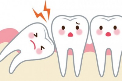 Mẹo giảm đau khi mọc răng khôn hiệu quả nhất ngay tại nhà