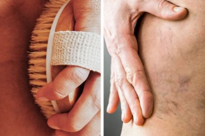 Những thói quen hằng ngày gây tổn thương cho tĩnh mạch