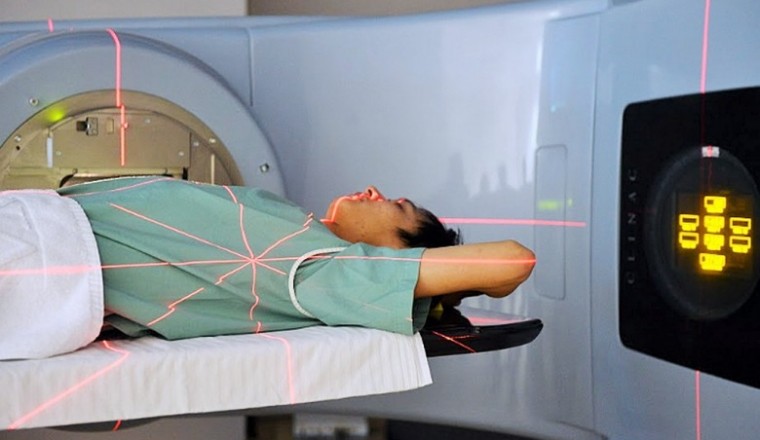 Xạ trị bệnh ung thư và những tác dụng phụ thường gặp nhất