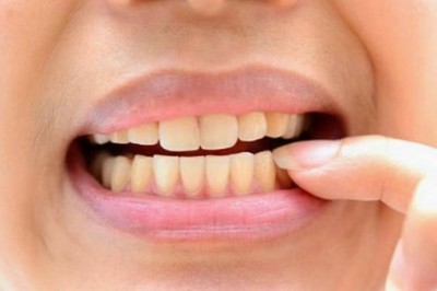 Những điều cần biết về kháng sinh và nhiễm trùng do răng