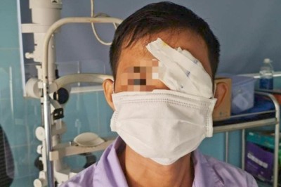 Mua cò về làm thịt một người đàn ông bị cò mổ thủng mắt