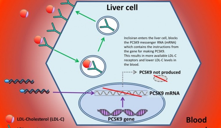Một mũi tiêm RNA có giá hơn 60 triệu, giúp hạ mỡ máu, phòng ngừa đột quỵ vừa được cơ quan y tế Anh chấp thuận