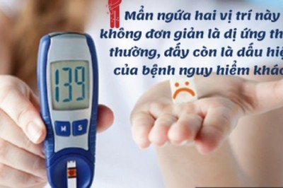 2 vị trí ngứa ngáy là dấu hiệu đường huyết tăng cao, bệnh tiểu đường rình rập: Tuyệt đối đừng chủ quan!