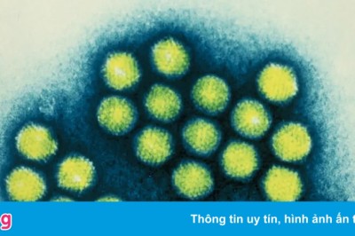 Hàng loạt ca nghi viêm gan bí ẩn được phát hiện ở Đông Nam Á