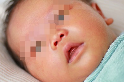 Viêm gan bí ẩn ở trẻ em khiến nhiều bố mẹ hoang mang: Bác sĩ gan mật giải thích cặn kẽ