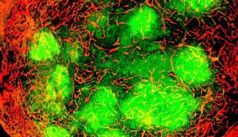 Tiêm virus diệt tế bào ung thư vào thẳng khối u