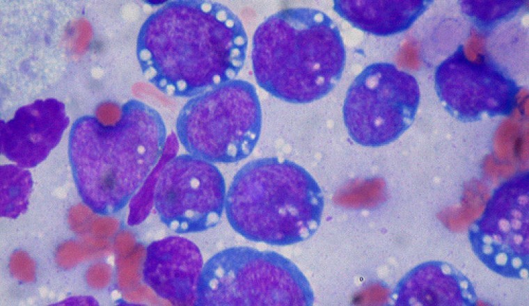 Phát hiện thuốc mới chữa khỏi ung thư