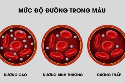Những loại trà là đồ uống giúp kiểm soát lượng đường trong máu và giảm kháng insulin